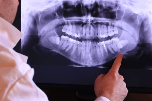 Best Emergency Root Canal Treatment in Oak Forest, IL